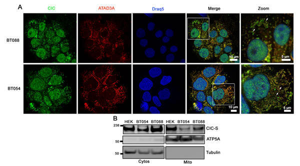 CIC-S localizes to mitochondria in 1p19q co-deleted oligodendroglioma cell lines.