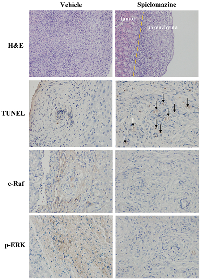 IHC analysis of tumor sections.