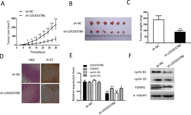 Knockdown of LOC653786 represses RCC xenograft growth and FOXM1 expression in vivo.