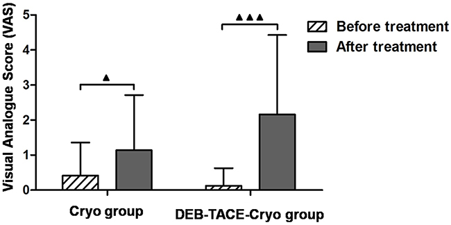 Preoperative and postoperative pain scores in patients with unresectable hepatocellular carcinoma (HCC) treated with transarterial chemoembolization using drug-eluting beads combined with cryoablation (DEB-TACE-Cryo) or cryoablation (Cryo).