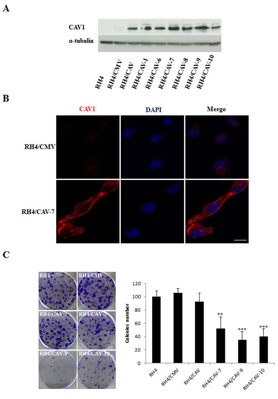 Effects of CAV1 transfection in the RH4 cell line.