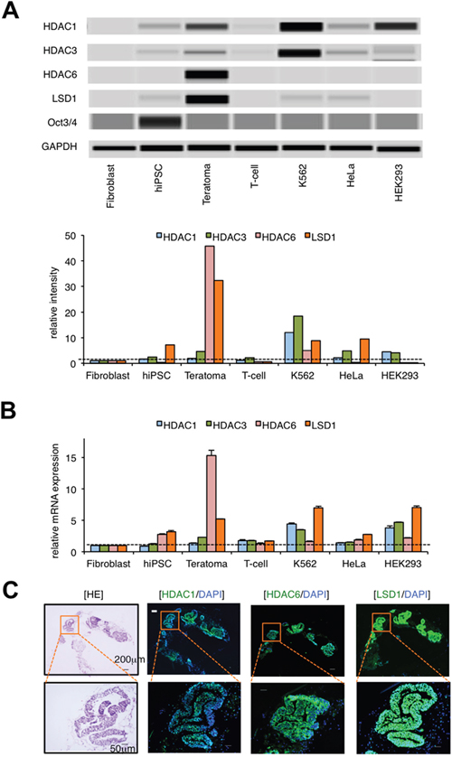 LSD1 is minimally expressed in hiPSCs but strongly expressed in hiPSC-derived teratoma.