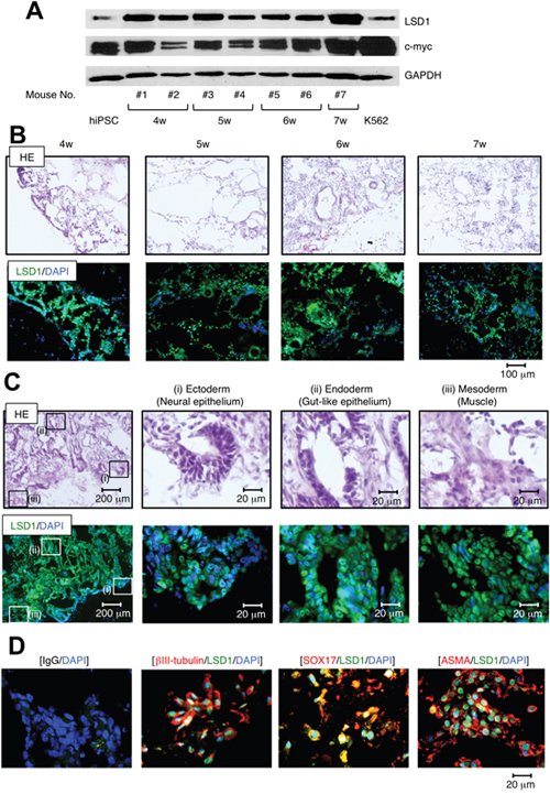 LSD1 is strongly expressed in derivatives of all three germ layers during teratoma formation and growth.