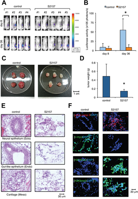 Administration of the LSD1 inhibitor S2157 prevents teratoma formation from hiPSCs.