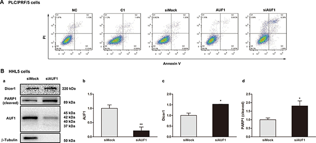 Inhibited expression of AUF1 promotes HCC cell death.