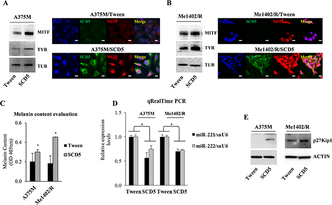 SCD5 overexpression drives melanoma cell lines toward differentiation.