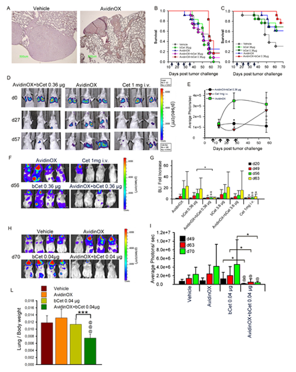 Aerosol treatment with AvidinOX and bCet is effective against A549 metastatic lung cancer.