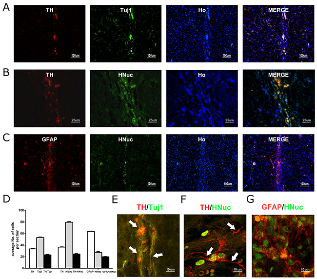 The long-term survival of grafted hUC-MSCs and DA neurons derived from hUC-MSCs in the striatum of 6-OHDA-lesioned rat.
