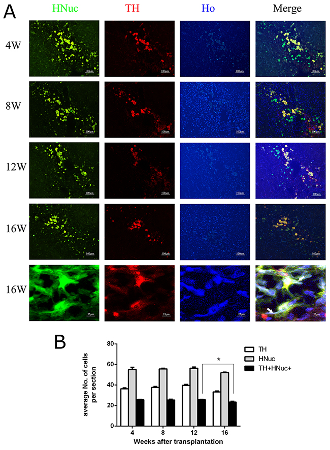 The persistent in vivo survival of DA neurons from transplanted hUC-MSCs.
