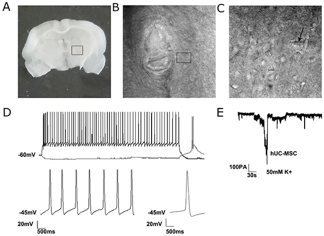 The electrophysiological recordings of differentiated neurons from grafted hUC-MSCs in a 6-OHDA lesioned rat.