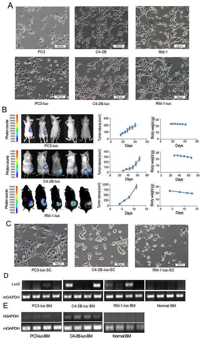 PCa cells undergo EMT and disseminate to bone marrow in mouse models.