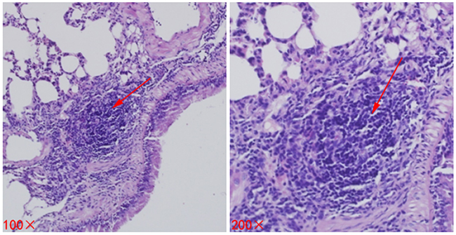 Metastases (lesions) in lung tissues of mice.