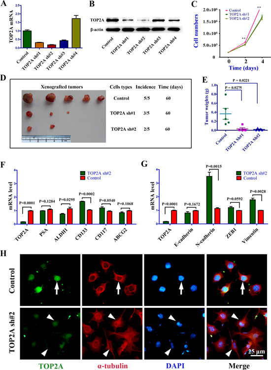 The phenotypes of DU145 cells following TOP2A inhibition by shRNAs.