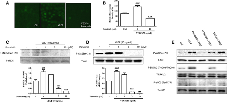 Effects of Ponatinib on VEGF-stimulated Akt/eNOS/NO pathway.