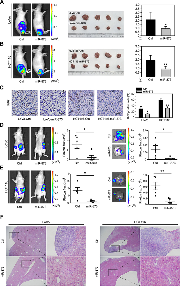 MiR-873 suppresses CRC cell growth and liver metastasis