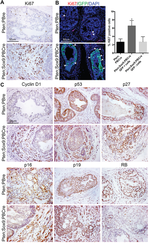 High levels of Sox9 promote proliferation of Pten deficient prostate cells.