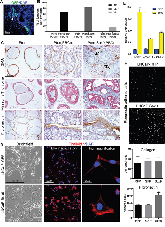 Sox9 promotes epithelial invasion, F-actin remodelling and adhesion to Fibronectin.