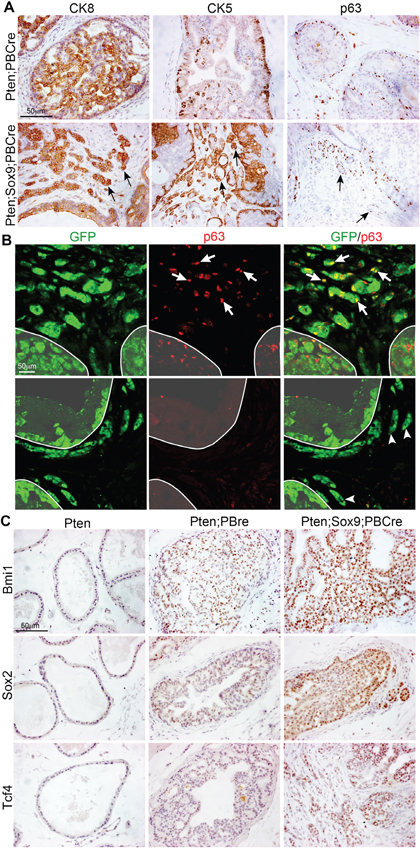 Sox9 promotes an increase in the expression of stem cell markers in Pten mutant prostate cells.
