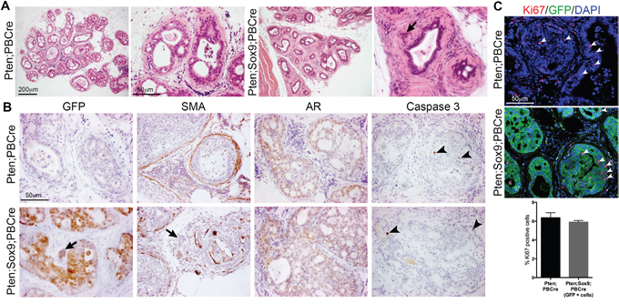 Castration of animals with Pten deletion and high Sox9 does not prevent epithelial invasion into the stroma.