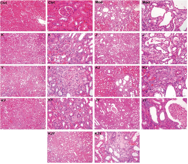 Representative histopathological micrographs of rat model of chronic renal failure with or without drug treatments for 5 weeks.