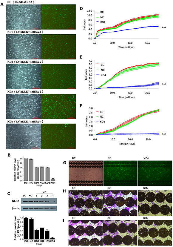 Infection of pancreatic cancer PANC-1 cells by lentivirus to knock down KLK7 expression, and compact of KLK7 gene silencing on PANC-1 cell proliferation, migration and invasion abilities identified by RTCA and microscopy.