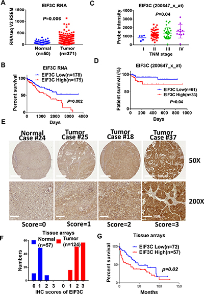 EIF3C is overexpressed and associated with poor patient survival in multiple HCC cohorts.