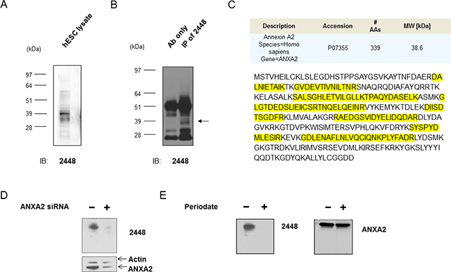 Identification of annexin A2 as the antigen target of 2448.