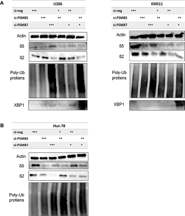 Altered expression of ubiquitinated proteins by co-inhibition of expression of PSMB5 and PSMB7 in tumor cells.