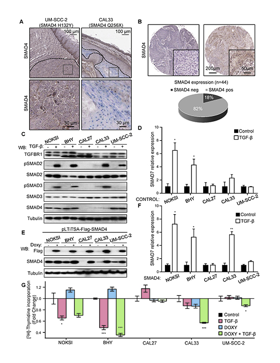 Figure 3. Aberrant TGF-&#x03B2; signaling in HNSCC and the OPC-22 panel.