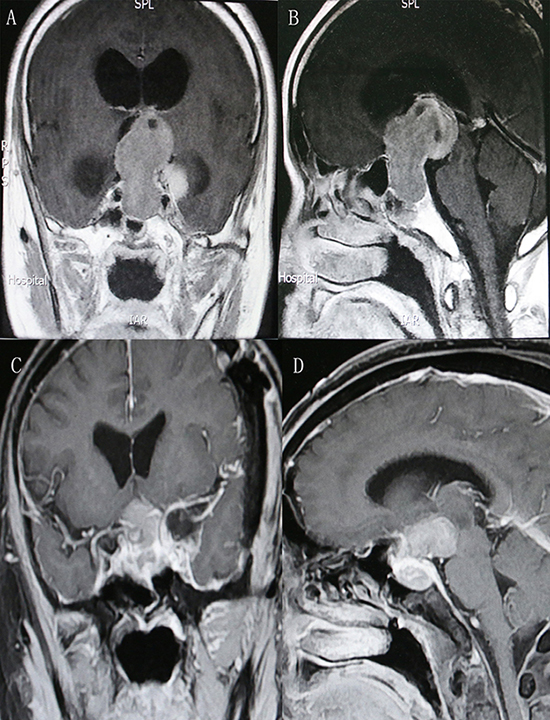 Figure 2: