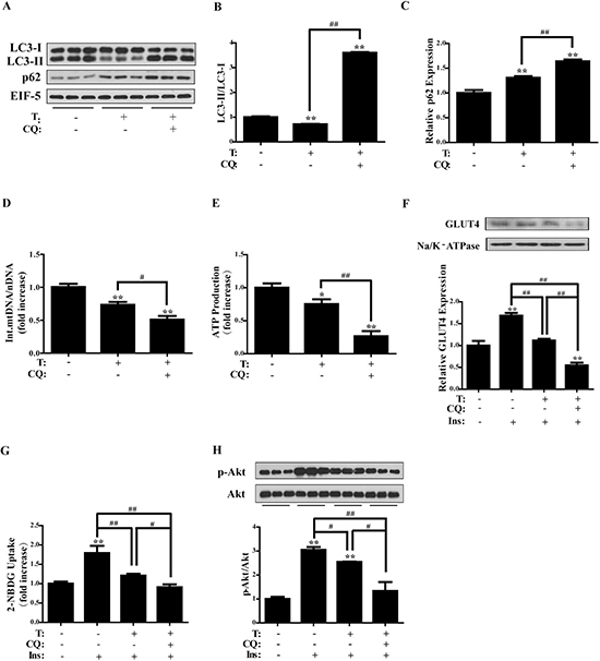 Effects of chloroquine on testosterone-treated C2C12 cells.