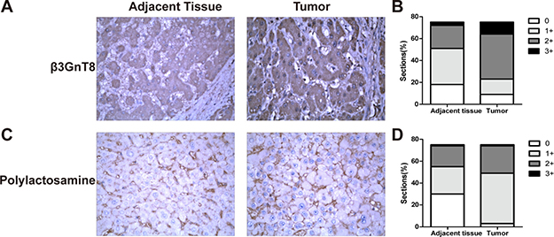 &#x03B2;3GnT8 expression in HCC cell lines and tissues.