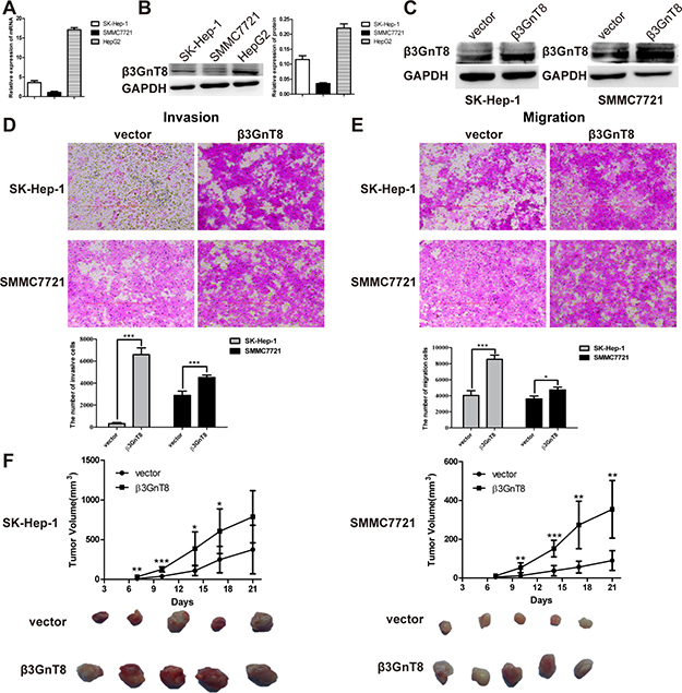 The effects of &#x03B2;3GnT8 on HCC migration and invasion in vitro and tumorigenesis in vivo.
