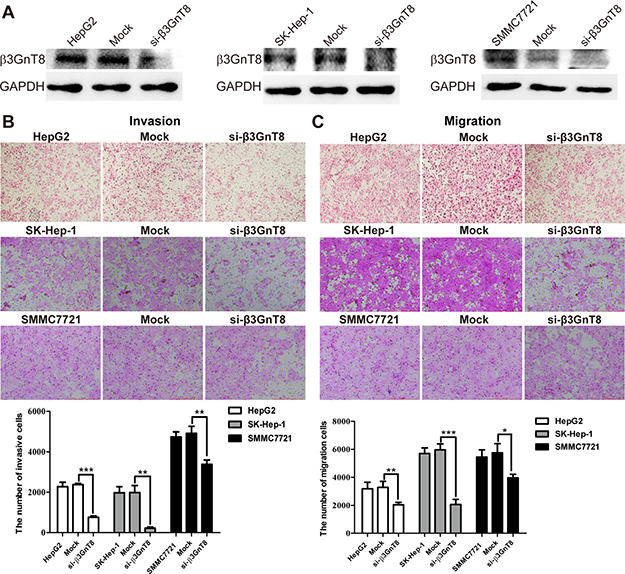 The effects of &#x03B2;3GnT8 knockdown on HCC invasion and migration in vitro.