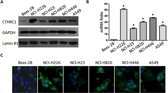 Figure1: Protein and mRNA expression characteristics of CTHRC1 in BEAS-2B and NSCLC cell lines.