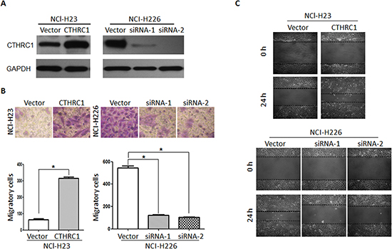 Aberrant expression of CTHRC1 promotes the invasion and migration of NSCLC cells in vitro.