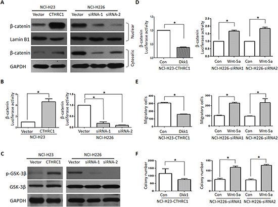 CTHRC1 promotes aggressiveness of NSCLC via activating Wnt/&#x03B2;-catenin pathway.