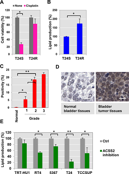 Cisplatin resistance is associated with ACSS2.