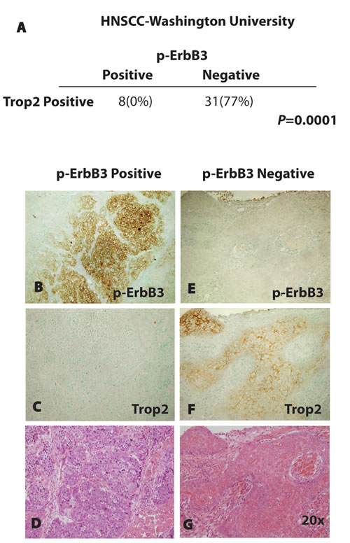 Inverse Correlation Between Trop2 and p-ErbB3 in Primary HNSCC.