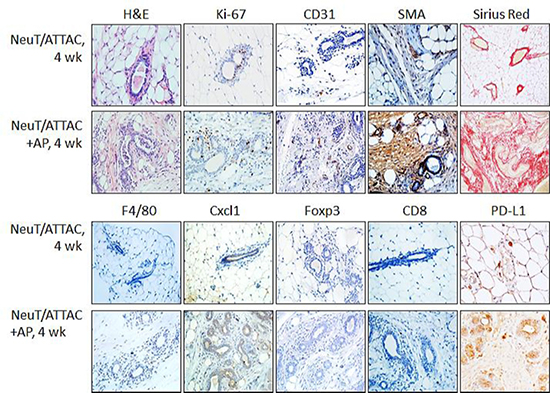 Induction of fibrosis in the mammary gland of NeuT/ATTAC mice following AP21087 treatment for four weeks.