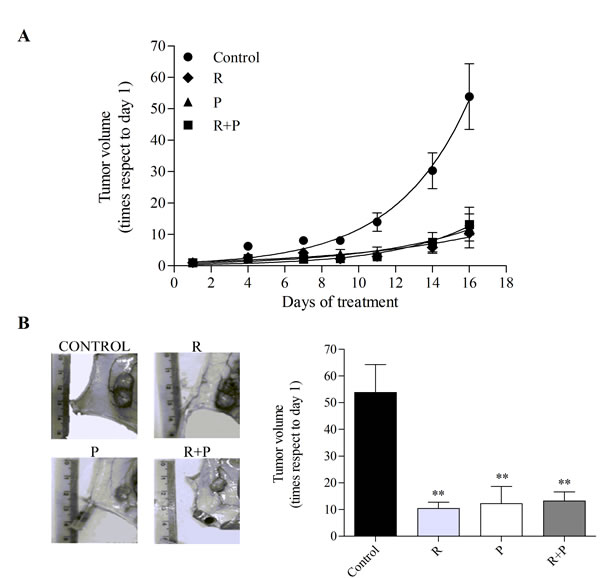 Effect of MRP and PDE4 inhibition on mouse AML tumor volume.