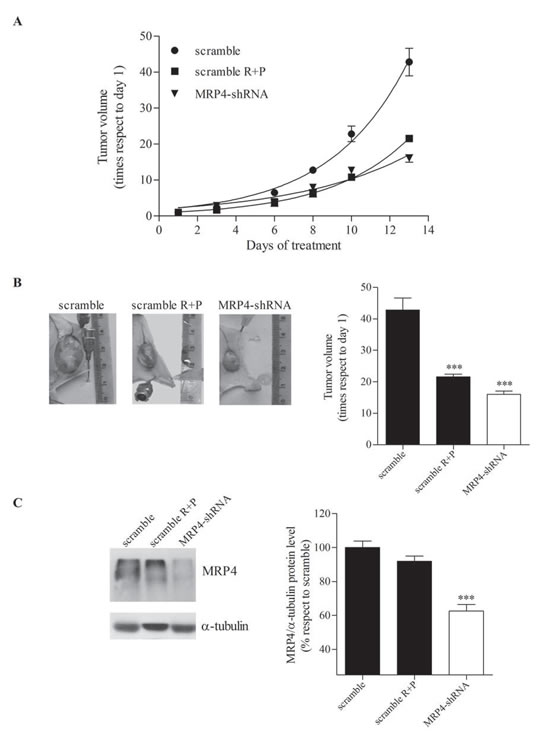 Effect of MRP4 knockdown on mouse AML tumor volume.