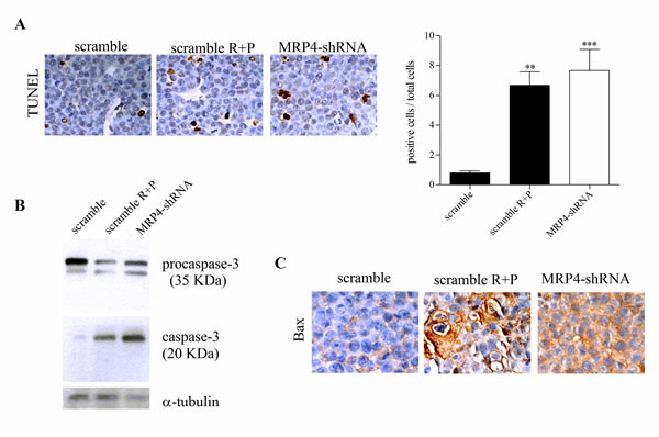 Pro-apoptotic activity of MRP4 knockdown in AML