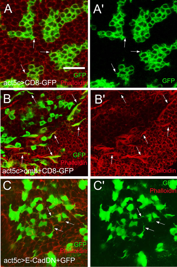 Actin-rich cellular protrusions in migratory