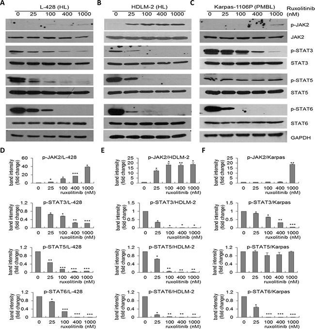 Downregulation of p-STAT3, p-STAT5 and p-STAT6 expression in HL and PMBL by ruxolitinib.