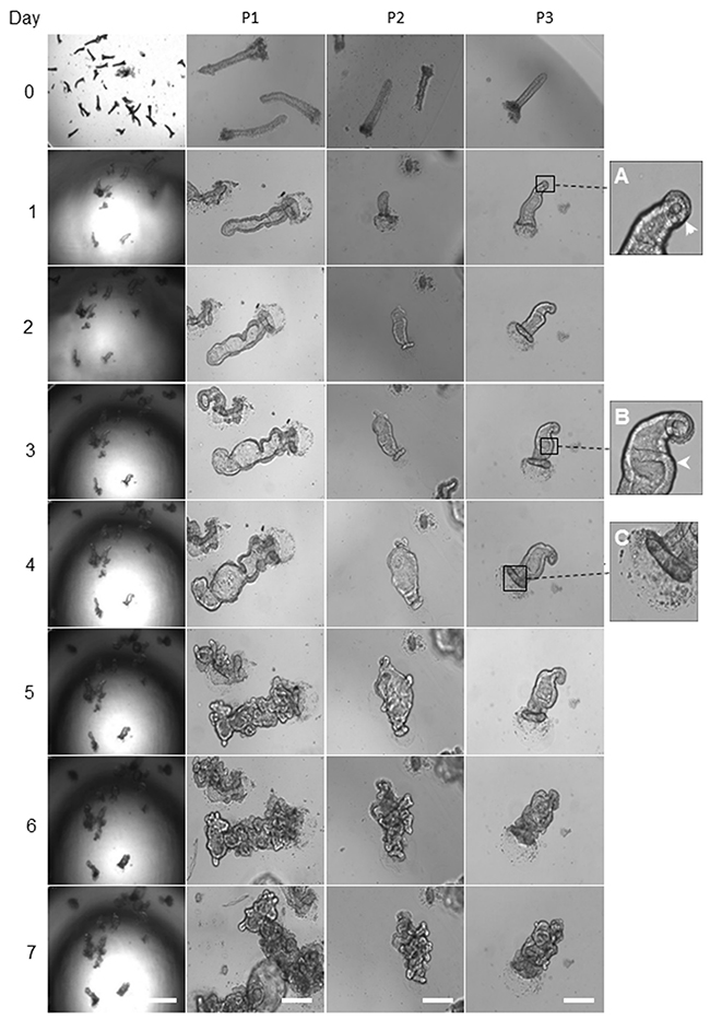 Representative images of morphology alteration in healthy colon organoids.