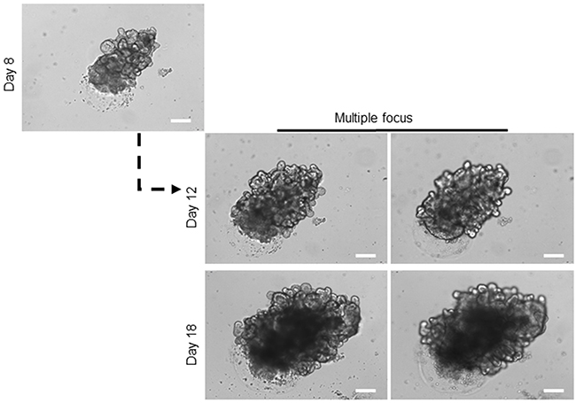 Long-term expansion of healthy organoids.