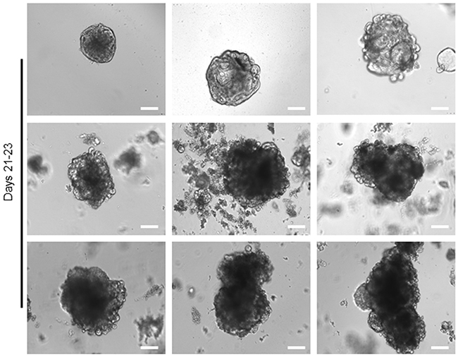 Long-term expansion of tumour organoids.