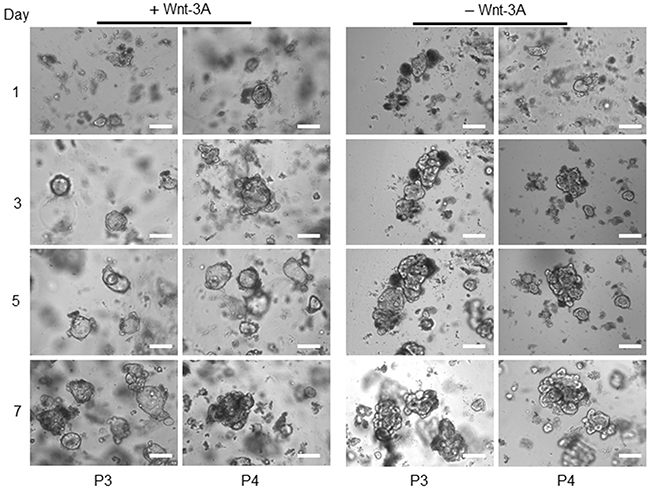 Tumour organoids growth in the presence and absent of Wnt-3A.