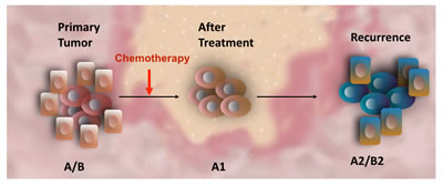 Effect of Chemotherapy on Cancer Stem Cells.